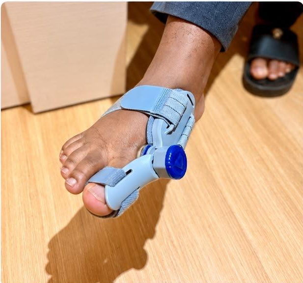 Adjustable bunion Corrector